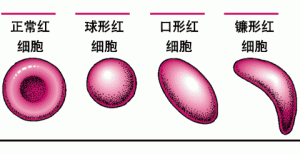 真性红细胞增多症特效药芦可替尼价格如何？
